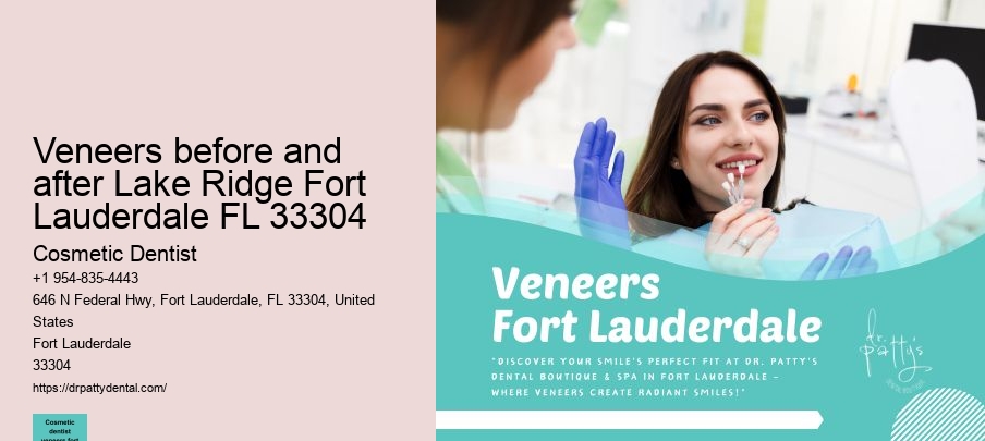 veneers before and after Lake Ridge Fort Lauderdale FL 33304