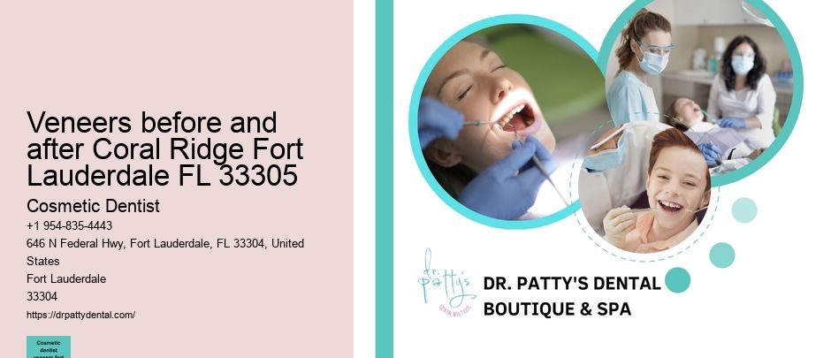 veneers before and after Coral Ridge Fort Lauderdale FL 33305