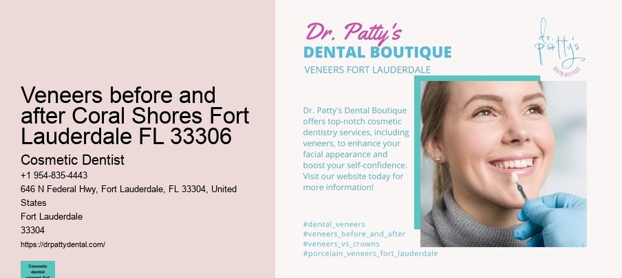veneers before and after Coral Shores Fort Lauderdale FL 33306